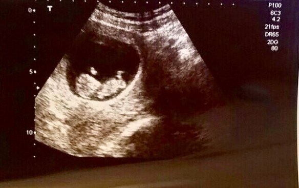 632EE79C-FA3D-400D-8B33-40793CC07BFF